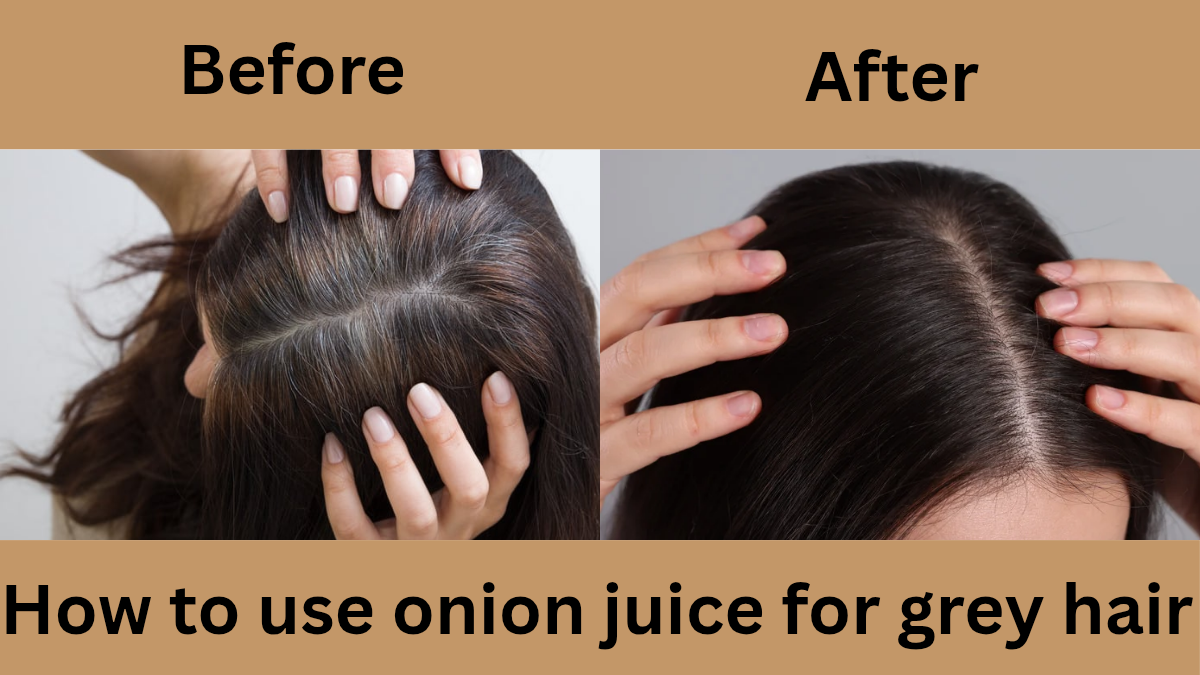 How to use onion juice for grey hair