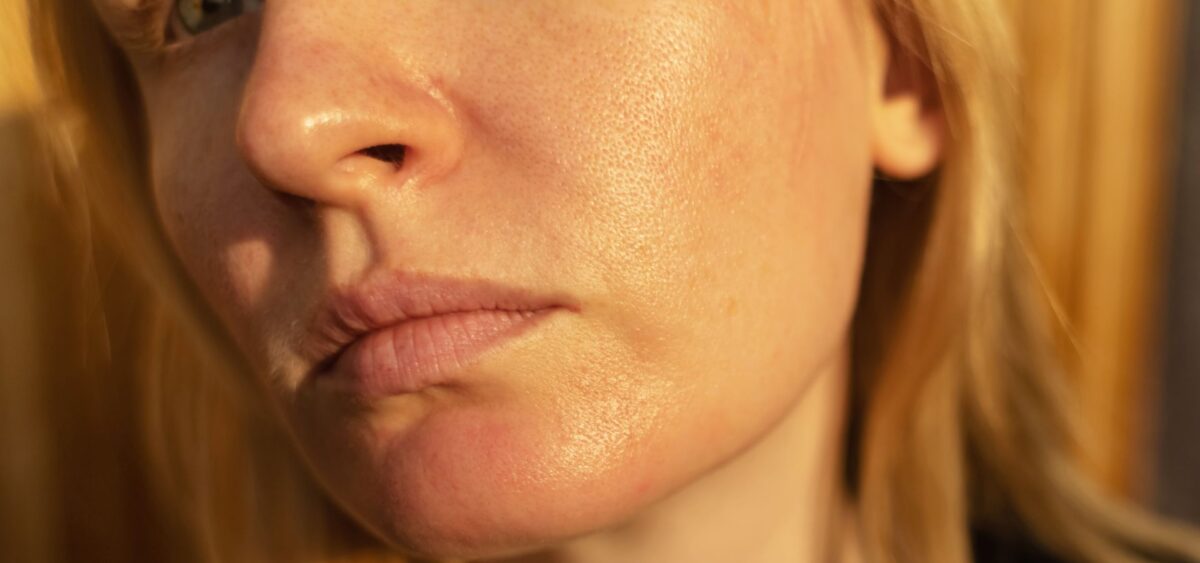 Clean beauty routine for oily skin using gentle natural ingredients to control oil and prevent breakouts