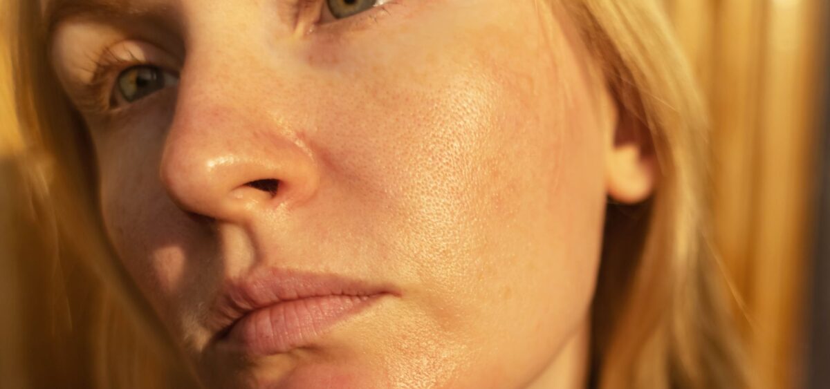 How to control excess oil on face using proper skincare routine and oil balancing methods