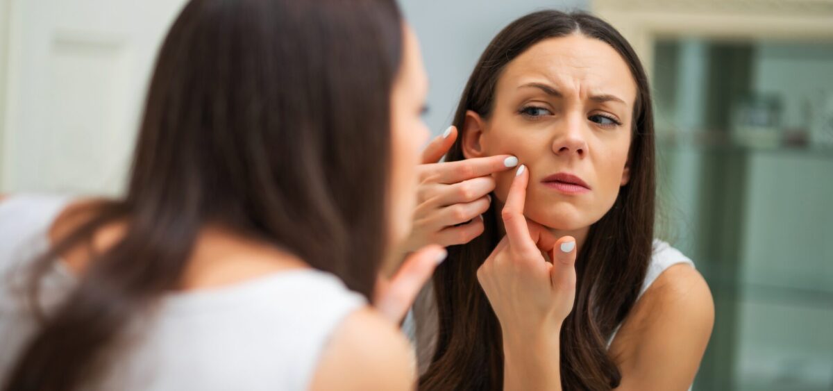 Minimalist skincare routine for acne with simple steps to control breakouts and improve skin