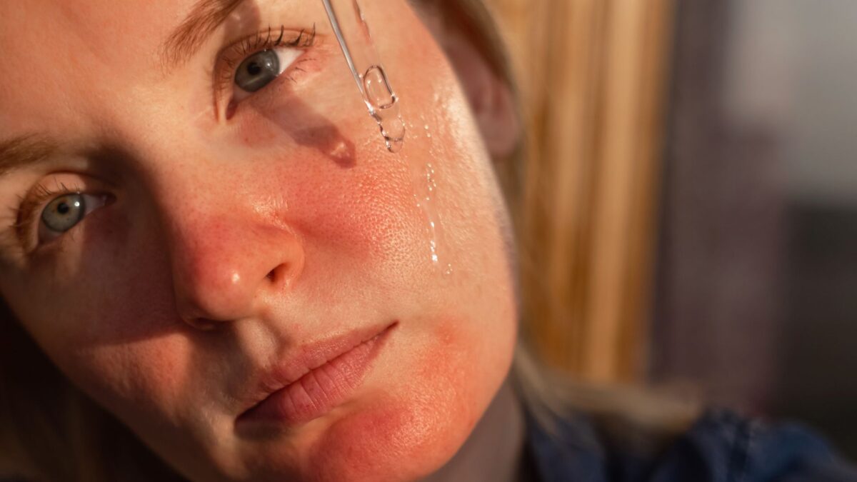 niacinamide serum benefits for oily acne prone skin with clear skin results