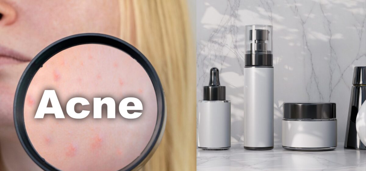 Pregnancy safe acne products with gentle ingredients that treat acne without harming skin during pregnancy