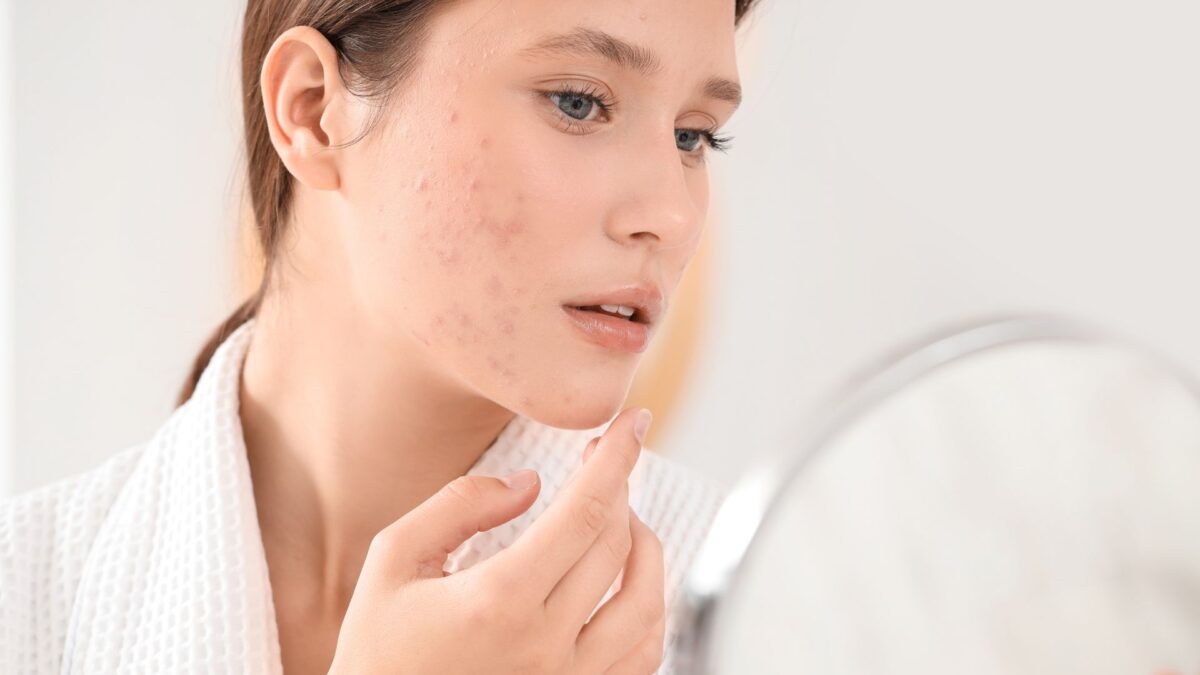 skincare layering order for oily acne prone skin showing correct product steps