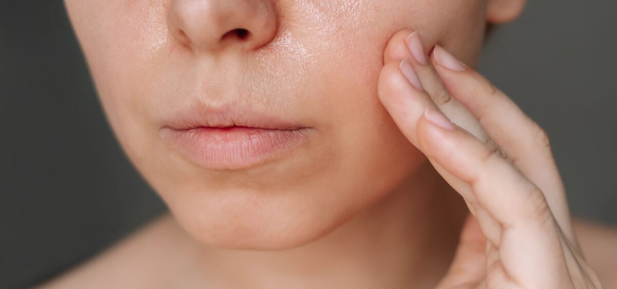 Why oily skin still needs moisturizer to maintain hydration balance and prevent excess oil production